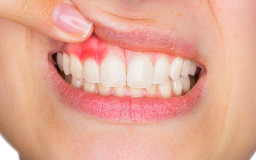 Dental and Gum Pain